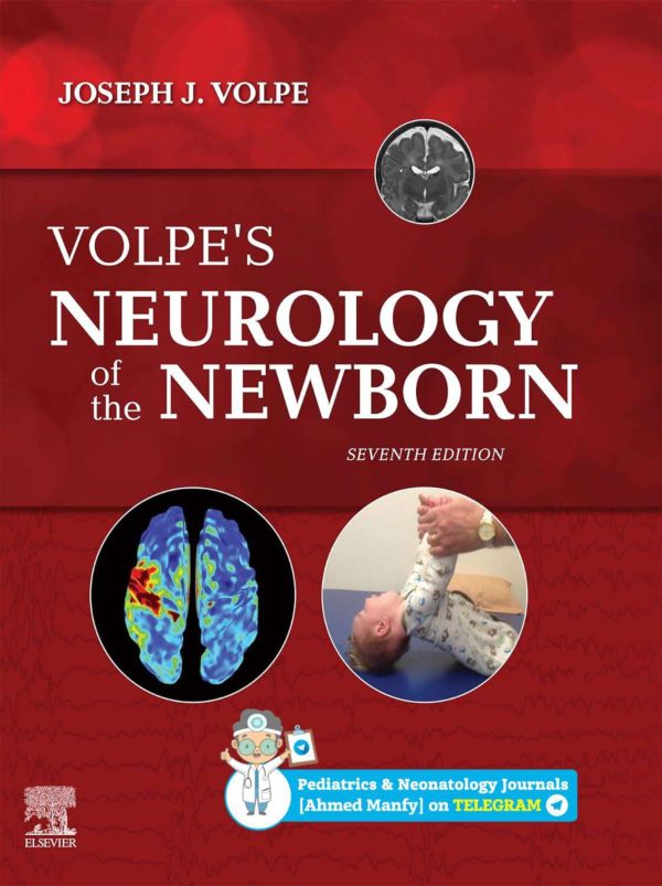 Volpe's Neurology of the Newborn 7th Edition
